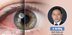 जलबिन्दुबाट हुने अन्धोपनको कुनै उपचार छैन : लक्षण पनि देखिदैन